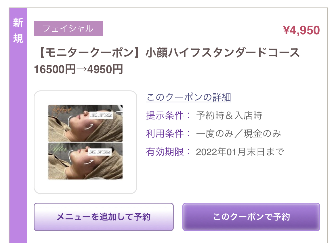 F3CDE5B9-3D29-43B6-9A52-A9ABA8B60B7C